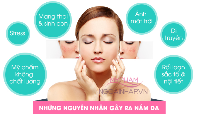 nguyên nhân gây ra nám da